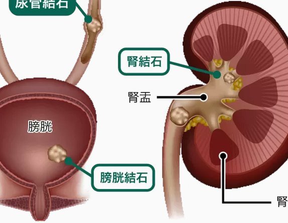 白条取现到账真相揭秘