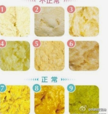 便便卡怎么用：掌握肠道健康的科学密码
